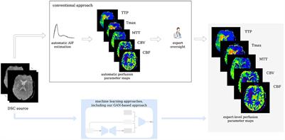 Image-to-image generative adversarial networks for synthesizing perfusion parameter maps from DSC-MR images in cerebrovascular disease